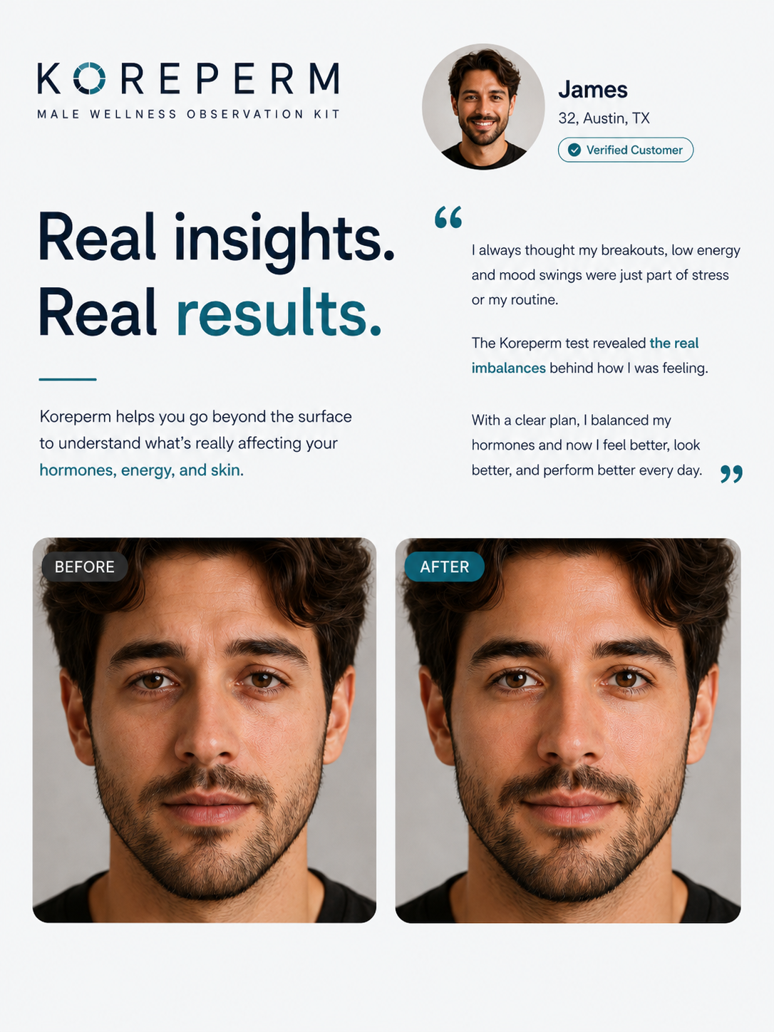 KOREPERM Insight Kit — Male Wellness Observation